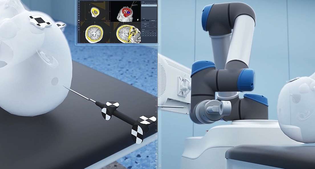 医疗三维动画制作 医疗三维动画制作